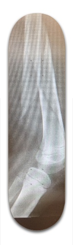 Design 125245