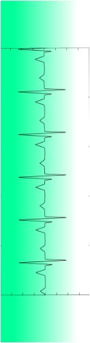 Heart Beat Signal Skateboards, Longboards and Grip Tape Image